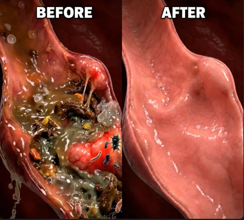 Illustration showing a before and after view of the gut